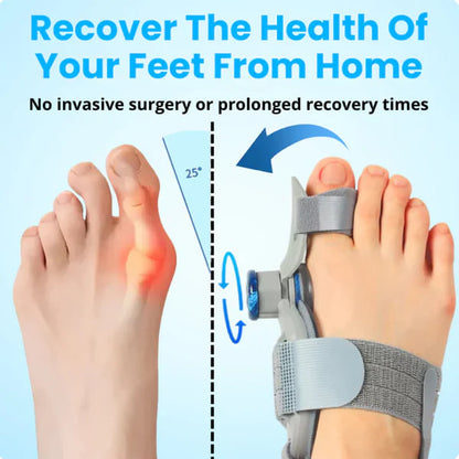 AlignToe Pro - Non-Surgical Relief for Bunion Pain